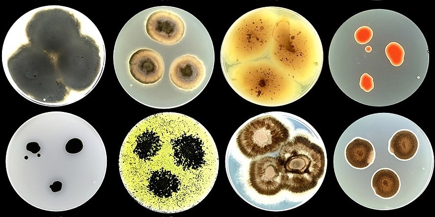 Living Tattoos: Microbial Inks Could Redefine Building Design